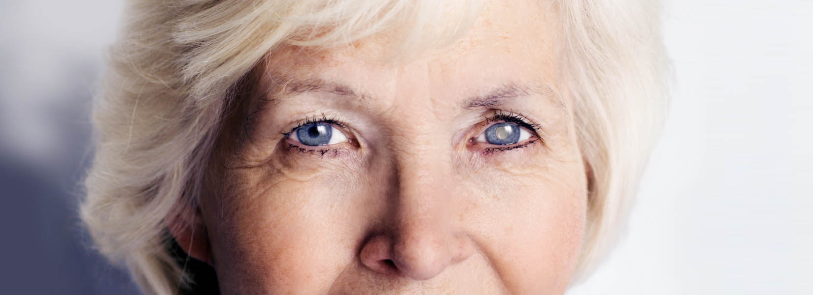 Cataract Surgery in Coles Crossing South